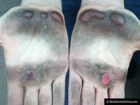 Pictured: After the exercise, a concerned friend posted pictures of a KMS
Cosmetics employee's hands. 